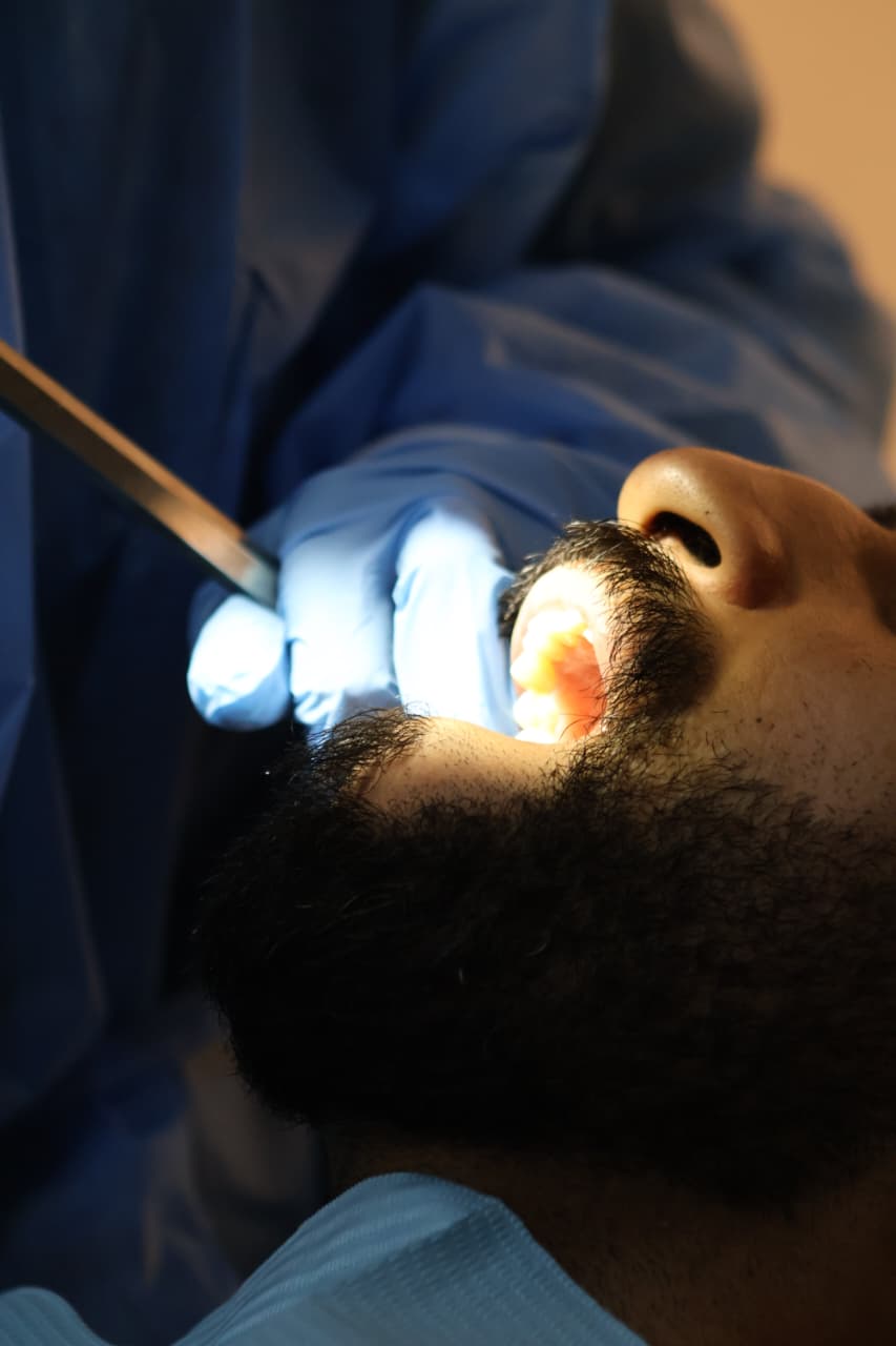 Affordable root canal treatment contact handsome dental clinic in Oman